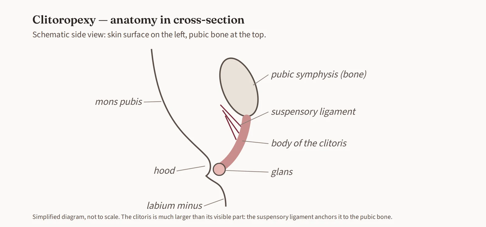 Lateral cross-section diagram of clitoral anatomy: pubic symphysis, suspensory ligament, shaft and glans of the clitoris, hood, mons pubis and labium minus